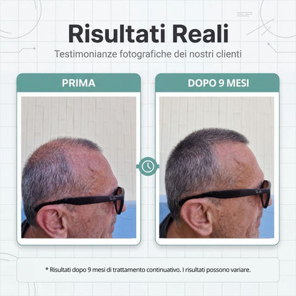 Routine Capelli Anticaduta con Cellule Staminali Vegetali: Shampoo e Lozione
